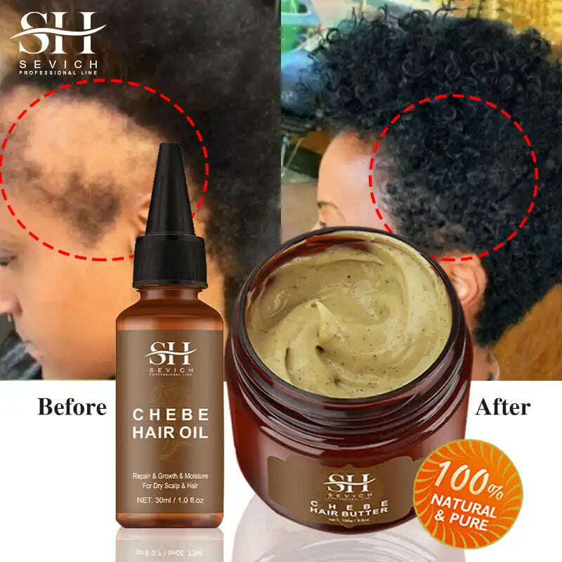 Fast Hair Growth Oil African Crazy Traction Alopecia Chebe Hair Mask Anti Hair Break Hair Strengthener Hair Loss Treatment Spray - KIMLUD