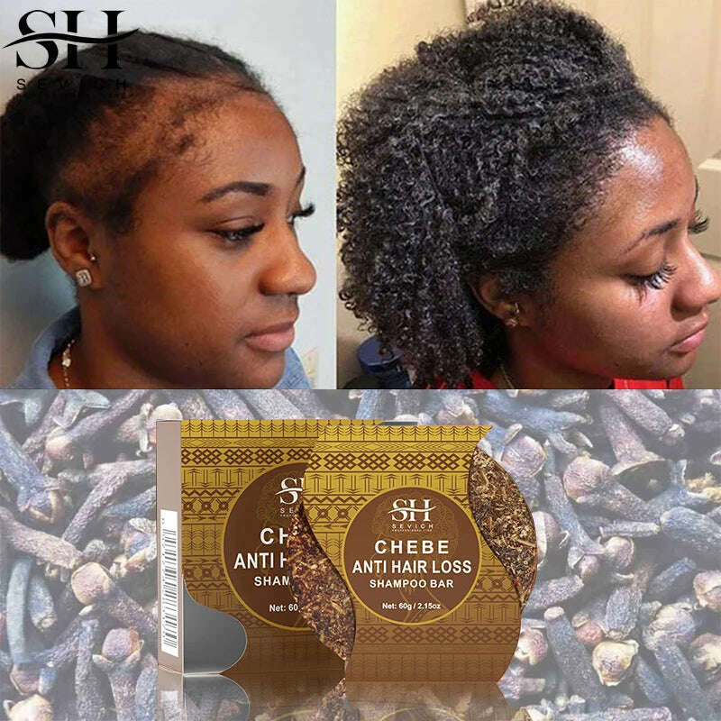 Fast Hair Growth Oil African Crazy Traction Alopecia Chebe Hair Mask Anti Hair Break Hair Strengthener Hair Loss Treatment Spray - KIMLUD