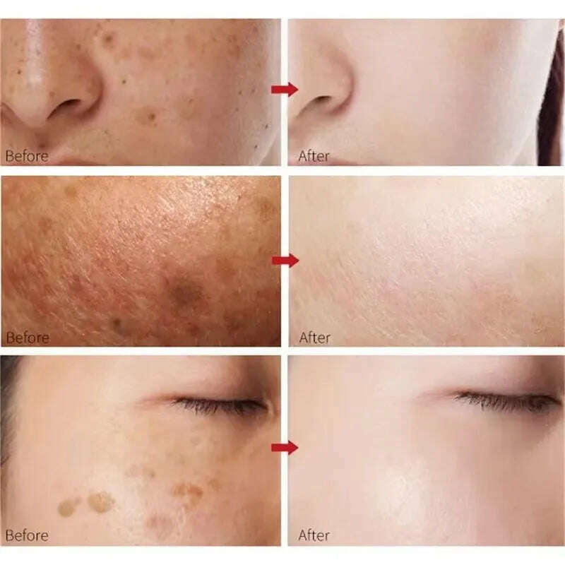 Peach 70% Niacinamide Serum 30ml Moisturizing Prevent Dryness Facial Essential Oil Increasing Elasticity Smooth Soften Skin Care - KIMLUD