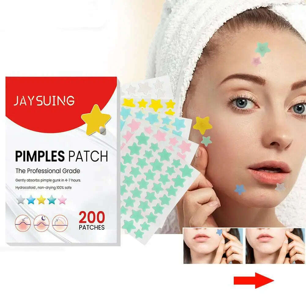 KIMLUD, 200pcs Star Pimple Patch Acne Colorful Invisible Acne Removal Skin Care Stickers  Face Spot Beauty Makeup Tool, KIMLUD Womens Clothes