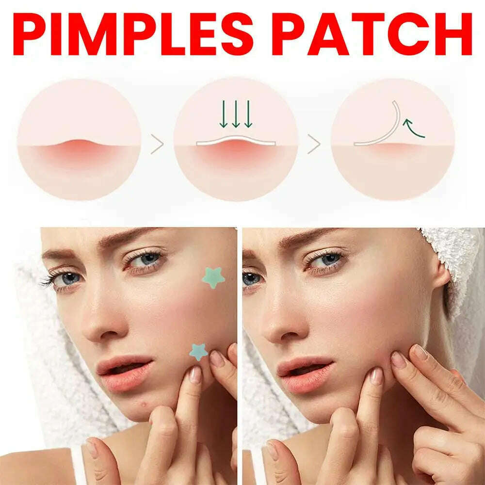 KIMLUD, 200pcs Star Pimple Patch Acne Colorful Invisible Acne Removal Skin Care Stickers  Face Spot Beauty Makeup Tool, KIMLUD Womens Clothes