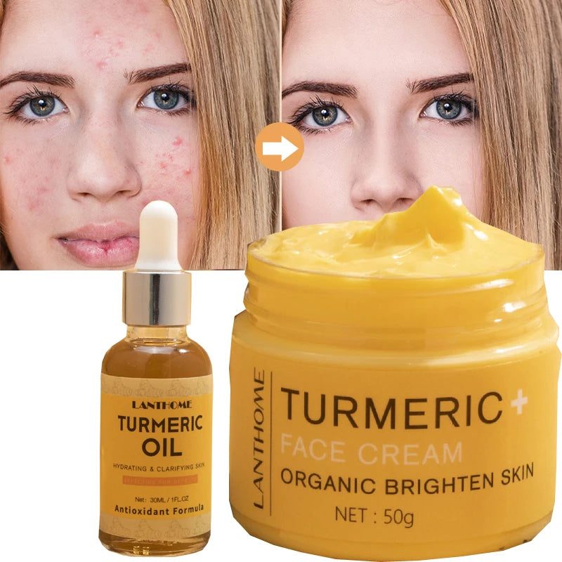 KIMLUD, Turmeric Skin Care Set Shrink Pores Moisturizing Whitening Facial Oils Nourish Smooth Face Acne Brightening Cream For Age Spots, KIMLUD Womens Clothes