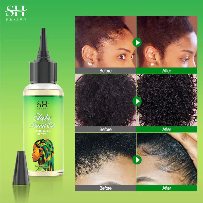 Sevich Chebe Hair Growth Serum Africa Traction Alopecia Chebe Anti Hair Loss Treatment Crazy Fast Hair Growing Oil Hair Care