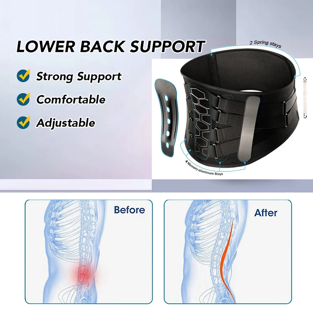 KIMLUD, 1PCS Back Brace for Lower Back Pain,Lumbar Support Belt for Men Women,Bionic Spine Design Back Brace for Sciatica Herniated Disc, KIMLUD Womens Clothes