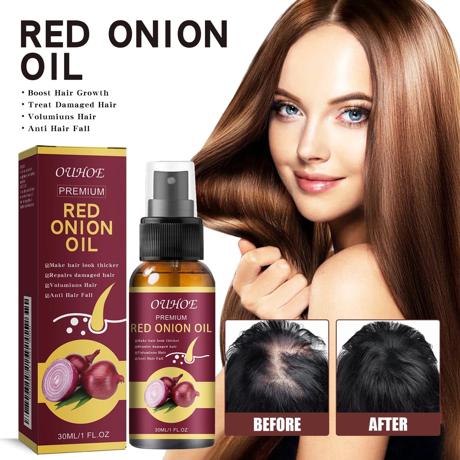 KIMLUD, Red Onion Hair Growth Essential Oil Hair Care Spray Prevent Hair Loss Nourish Hair Roots Improve Hair Texture Hair Care Products, KIMLUD Womens Clothes