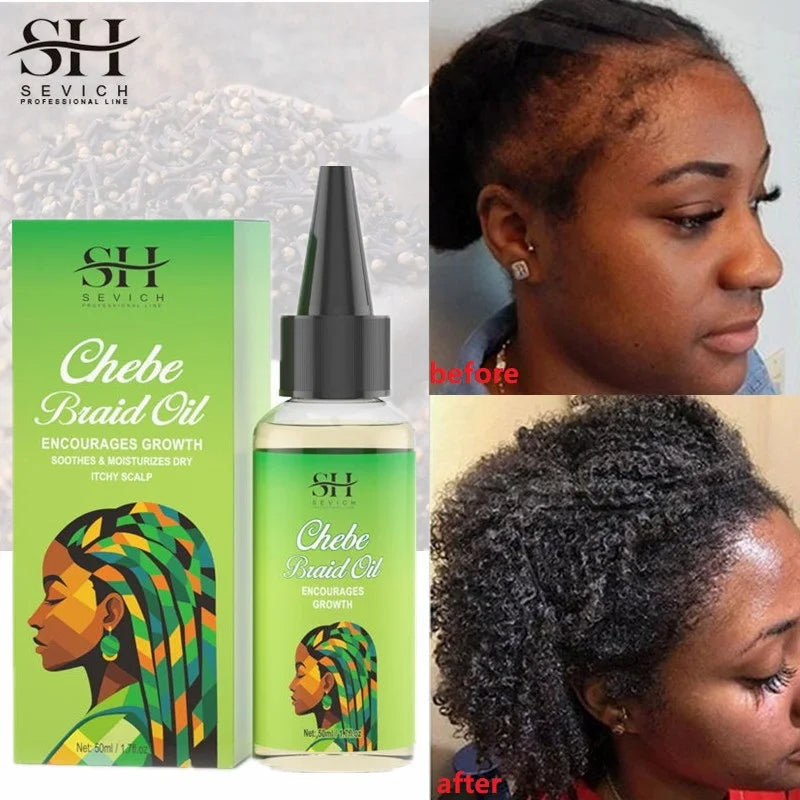 Sevich Chebe Hair Growth Serum Africa Traction Alopecia Chebe Anti Hair Loss Treatment Crazy Fast Hair Growing Oil Hair Care