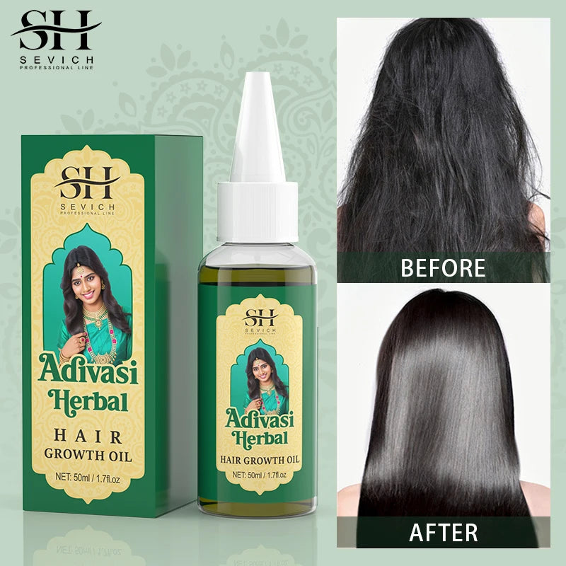 Sevich India Herbal Hair Growth Oil And Scalp Massager Comb Tool Set Ayurvedic Adivasi Fast Regrowth Thicken Serum Hair Growing
