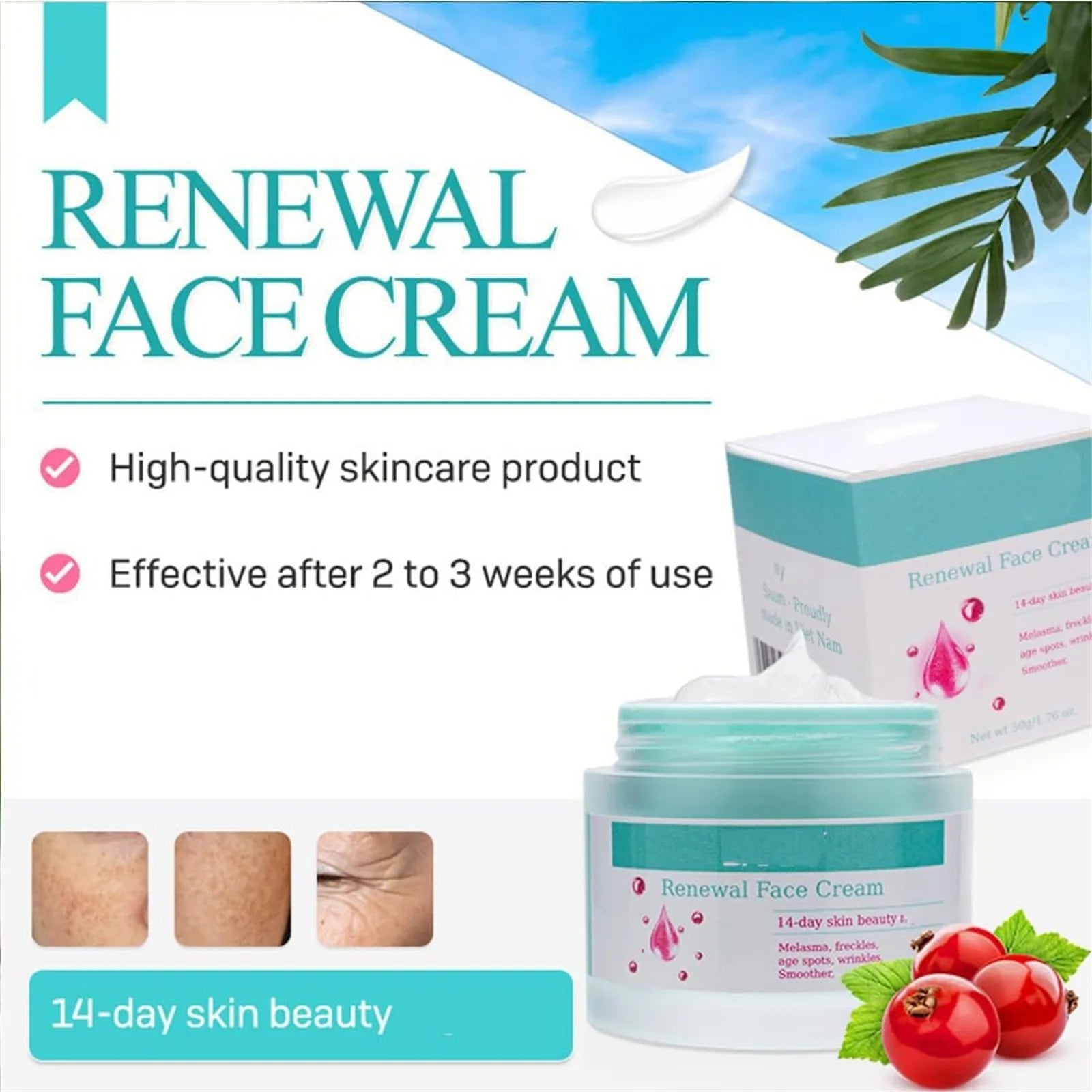 New Cream For Melasma, Nourishing And Moisturizing Skin Face Cream Anti-Wrinkle Reduces Dark Spots And Fine Lines