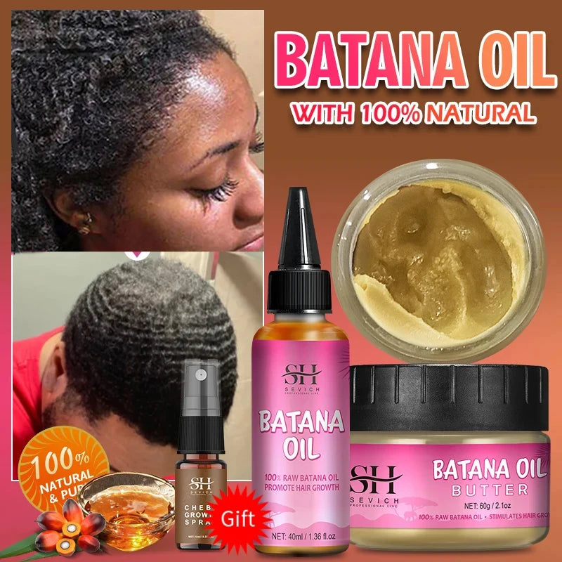 100% Batana Hair Fast Growth Oil Set African Crazy Traction Alopecia Batana Hair Mask chebe oil Hair Regrowth Treatment Sevich