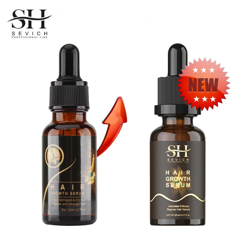 Sevich 20ml Ginger Extract Hair Growth Serum Prevent Hair Loss Oil Scalp Treatments Fast Growing Hair Care Products for Unisex