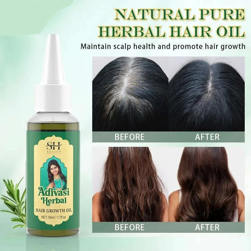 KIMLUD, Ayurvedic Hair Growth Oil India Adivasi Herbal Hair Oil Rosemary Anti Hair Loss Fast Regrowth Thicken Oils Hair Growth Products, KIMLUD Womens Clothes