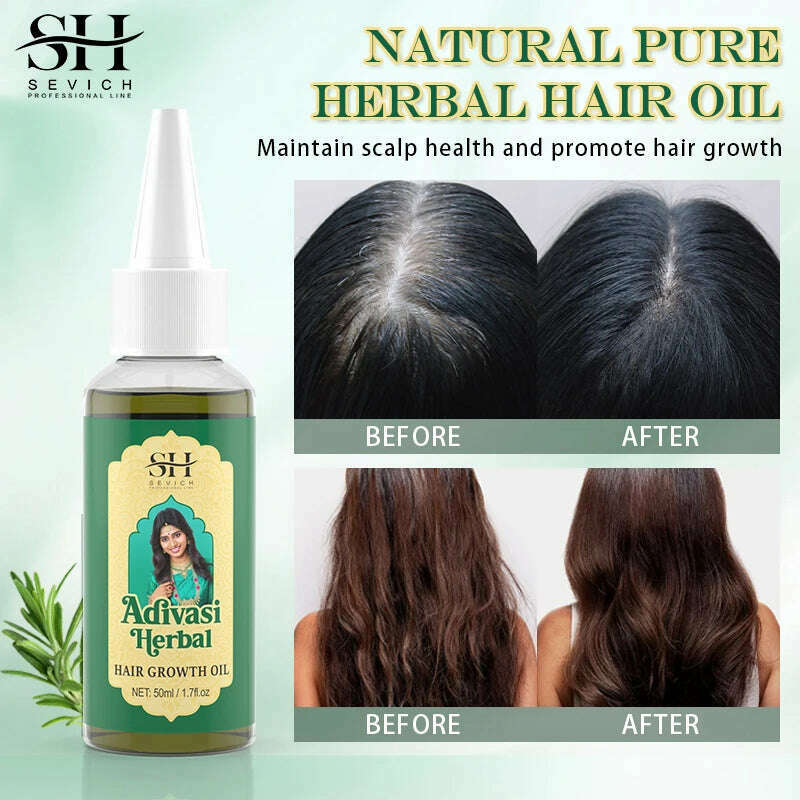 KIMLUD, Ayurvedic Hair Growth Oil India Adivasi Organic Hair Growth Serum Anti Hair Loss Fast Regrowth Thicken Oils Hair Growth Products, KIMLUD Womens Clothes