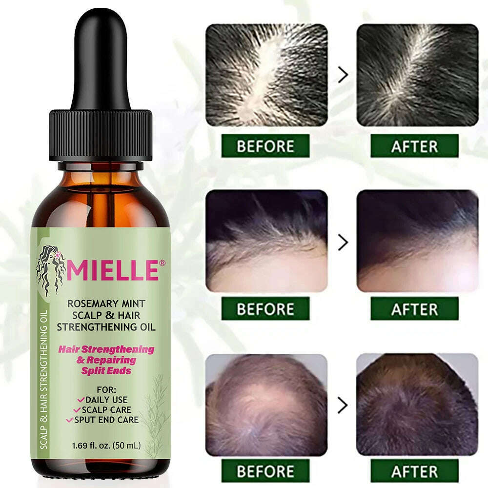 KIMLUD, Hair Growth Essential Oil Rosemary Mint Hair Strengthening Oil Nourishing Treatment for Split Ends and Dry Mielle Organics Hair, KIMLUD Womens Clothes