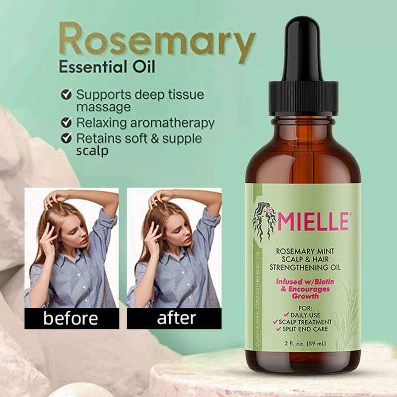 KIMLUD, Hair Growth Essential Oil Rosemary Mint Hair Strengthening Oil Treatment  Dry Mielle Organics Split Ends Hair Essential Oil, KIMLUD Womens Clothes