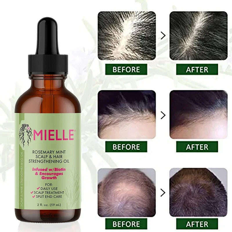 KIMLUD, Hair Growth Essential Oil Rosemary Mint Hair Strengthening Oil Treatment  Dry Mielle Organics Split Ends Hair Essential Oil, KIMLUD Womens Clothes