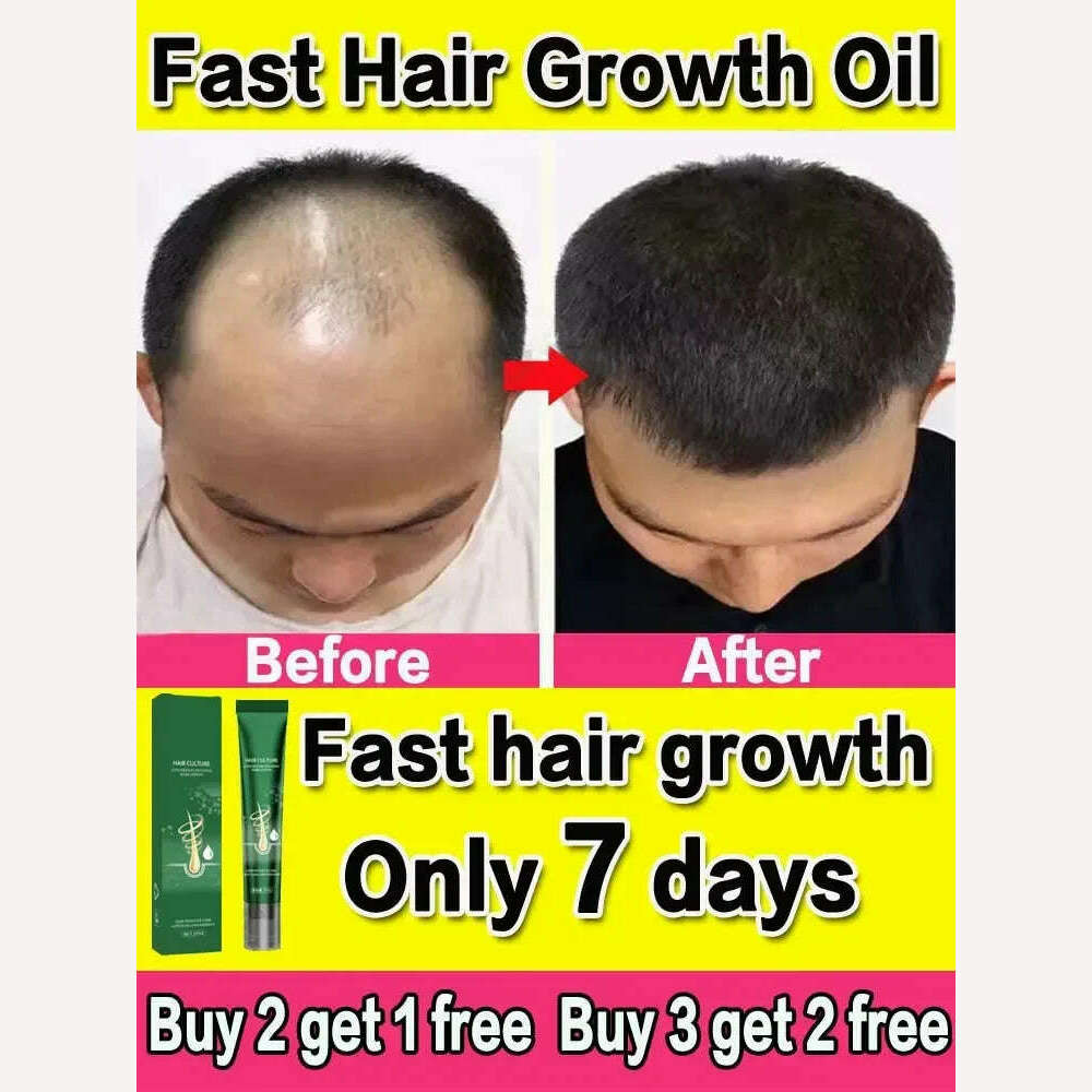 KIMLUD, Hair Growth Oil Fast Growing Hair Effective Essential Baldness Repair Hereditary Anti Postpartum Seborrheic Hair Loss Products, KIMLUD Womens Clothes