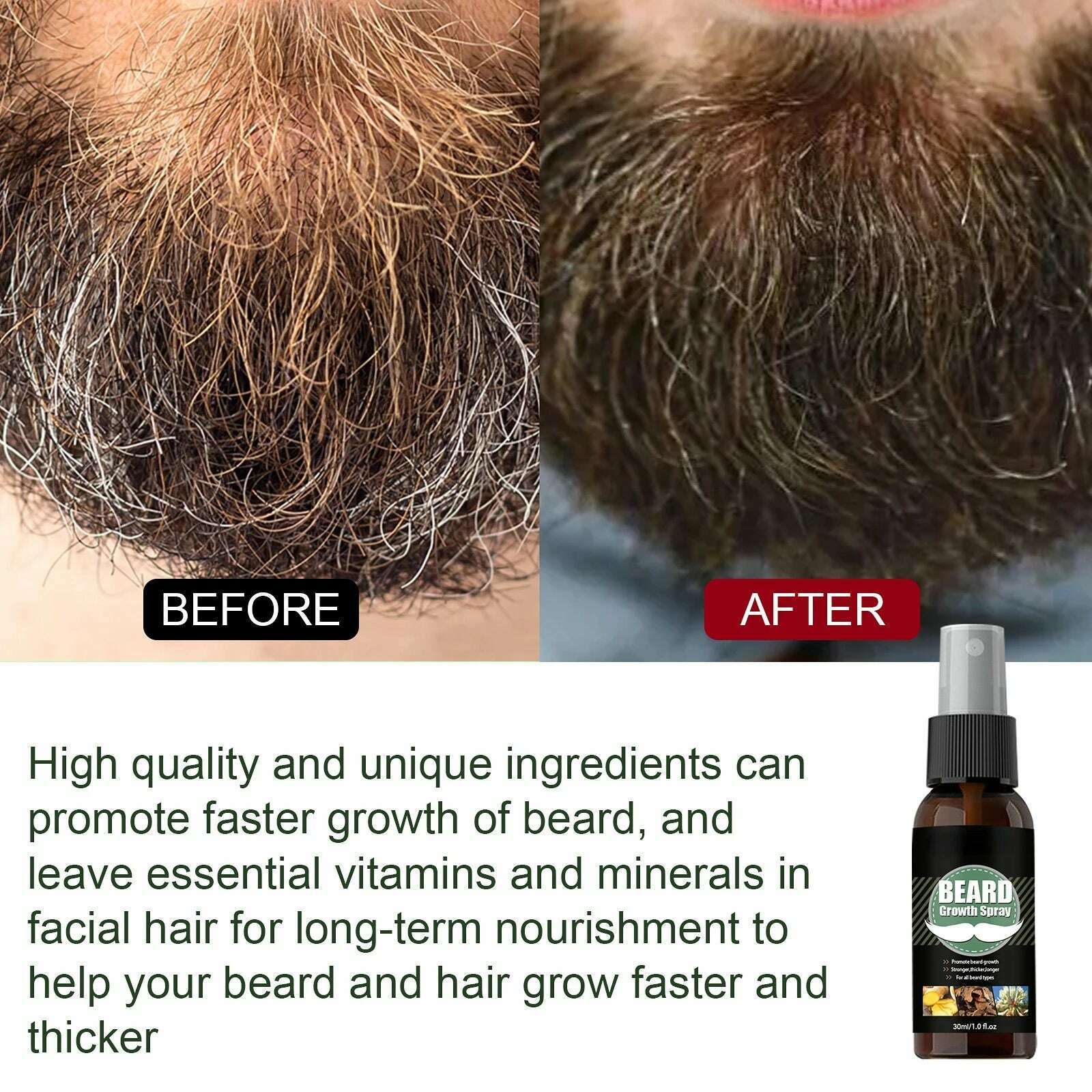 KIMLUD, Men Beard Growth Essential Oils Essence Spray Nourishing and Moisturizing Spray Beard Care Grooming Oil, KIMLUD Womens Clothes