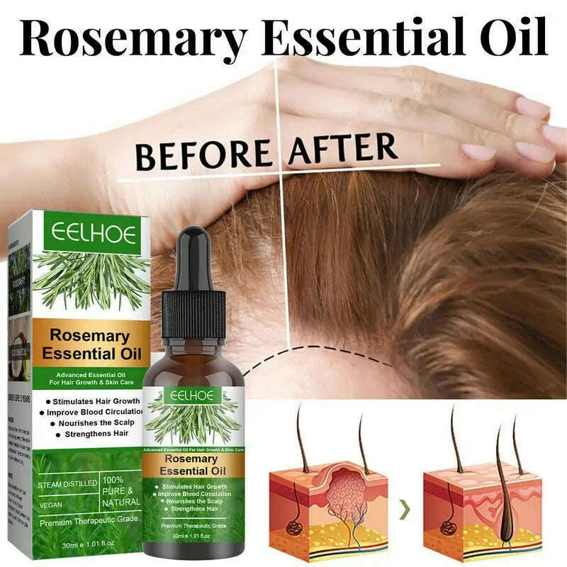 KIMLUD, Rosemary Essentiall Oil Hair Growth Products Organic Hair Products Scalp Hair Strengthening Oil For Nourish Shiny Hair Healthy, KIMLUD Womens Clothes