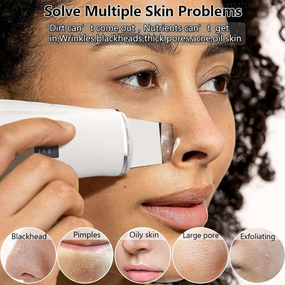 Ultrasonic Peeling Remover Blackhead Facial Skin Scrubber Facial Shovel Deep Cleaning Face Lifting Removal Pore Acne EMS Lift - KIMLUD